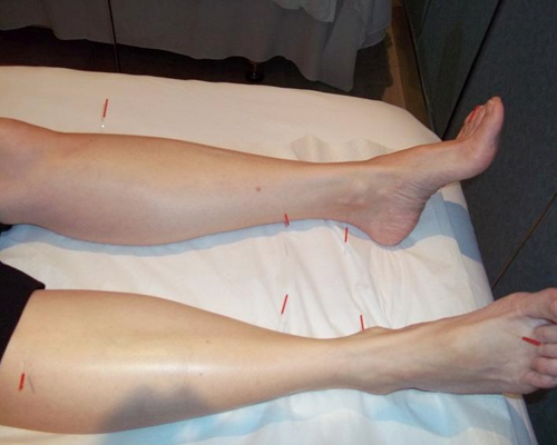 acupuncture-tab-other-img-55-1